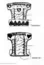 Fig. 07 - NAPPY