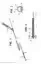 Fig. 02 - METHOD OF REMOVING A STYLETTE FROM A CATHETER