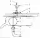 Fig. 01 - TRANSCECAL ILEOSTOMY SET