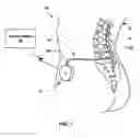 Fig. 02 - MODULAR MEDICAL PUMP