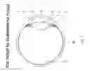 Fig. 02 - Laser system that is gentle on the eyes, for refractive surgery