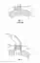 Fig. 02 - Method and Apparatus for RF Anastomosis