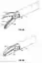 Fig. 05 - Electrosurgical instrument with time limit circuit