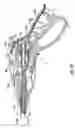 Fig. 15 - Electrosurgical instrument with time limit circuit