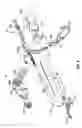Fig. 17 - Electrosurgical instrument with time limit circuit