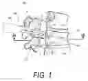 Fig. 02 - Bone treatment systems and methods