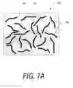 Fig. 09 - Bone treatment systems and methods