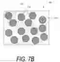 Fig. 10 - Bone treatment systems and methods