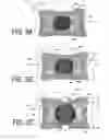 Fig. 13 - Bone treatment systems and methods