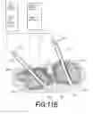 Fig. 16 - Bone treatment systems and methods