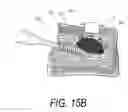 Fig. 22 - Bone treatment systems and methods
