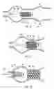 Fig. 04 - Method and system for delivery of coated implants