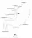 Fig. 02 - Endoscopic implant system and method