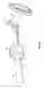 Fig. 09 - Endoscopic implant system and method