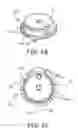 Fig. 08 - SNAP-ON SUTURE RING FOR IMPLANTABLE MEDICAL DEVICE