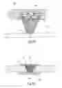Fig. 07 - Three Dimensional Implant