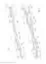 Fig. 02 - Endoscopic clipping device