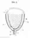 Fig. 07 - Endoscopic heart surgery method
