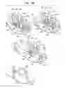 Fig. 05 - SYSTEM AND METHOD FOR BONDING LIVING TISSUE