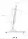 Fig. 06 - Vertical rehabilitation appliance