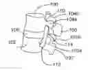Fig. 01 - Spinal stabilization devices, systems, and methods