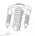 Fig. 06 - Method of lateral facet approach, decompression and fusion using screws and staples as well as arthroplasty