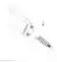 Fig. 08 - Method of lateral facet approach, decompression and fusion using screws and staples as well as arthroplasty
