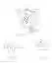 Fig. 02 - Orthopedic fastener blocking system
