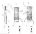 Fig. 04 - Pedicle screw assembly having a retractable screw tip for facilitating the  securement of the pedicle screw assembly to a spinal vertebra