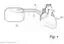 Fig. 02 - DEVICE AND METHOD FOR DETECTING AND TREATING A MYOCARDIAL INFARCTION USING PHOTOBIOMODULATION