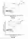 Fig. 08 - PATIENT STATE DETECTION BASED ON SUPPORT VECTOR MACHINE BASED ALGORITHM
