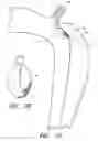 Fig. 08 - Percutaneous method and device to treat dissections