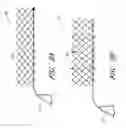 Fig. 09 - Percutaneous method and device to treat dissections
