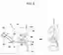 Fig. 07 - Drawstring for removal of stent