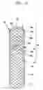 Fig. 13 - Drawstring for removal of stent