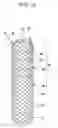 Fig. 14 - Drawstring for removal of stent