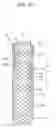 Fig. 16 - Drawstring for removal of stent