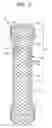 Fig. 22 - Drawstring for removal of stent