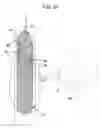 Fig. 25 - Drawstring for removal of stent