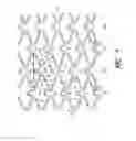 Fig. 05 - Stent with variable features to optimize support and method of making such stent