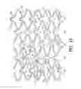 Fig. 07 - Stent with variable features to optimize support and method of making such stent