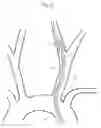 Fig. 04 - Implant delivery device