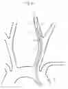 Fig. 05 - Implant delivery device