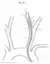 Fig. 06 - Implant delivery device