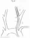 Fig. 10 - Implant delivery device