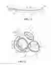 Fig. 08 - Mitral Valve Device Using Conditioned Shape Memory Alloy