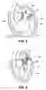 Fig. 06 - Heart valve prosthesis with collapsible valve and method of delivery thereof