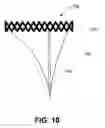 Fig. 09 - Heart valve prosthesis with collapsible valve and method of delivery thereof