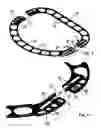 Fig. 03 - Adjustable annuloplasty rings