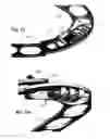 Fig. 09 - Adjustable annuloplasty rings